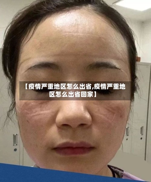 【疫情严重地区怎么出省,疫情严重地区怎么出省回家】-第3张图片